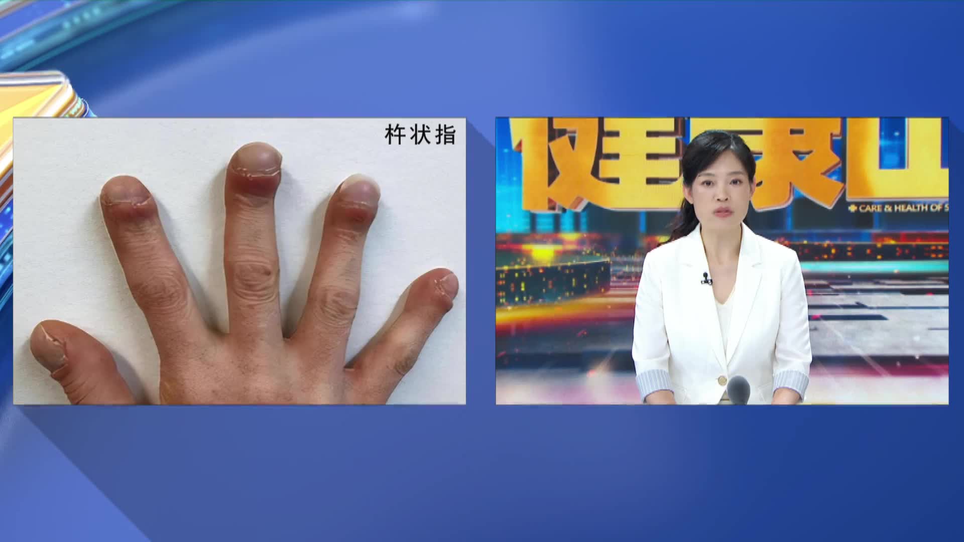 手指尖异常变粗？警惕！这可能是早期肺癌的“小提示”