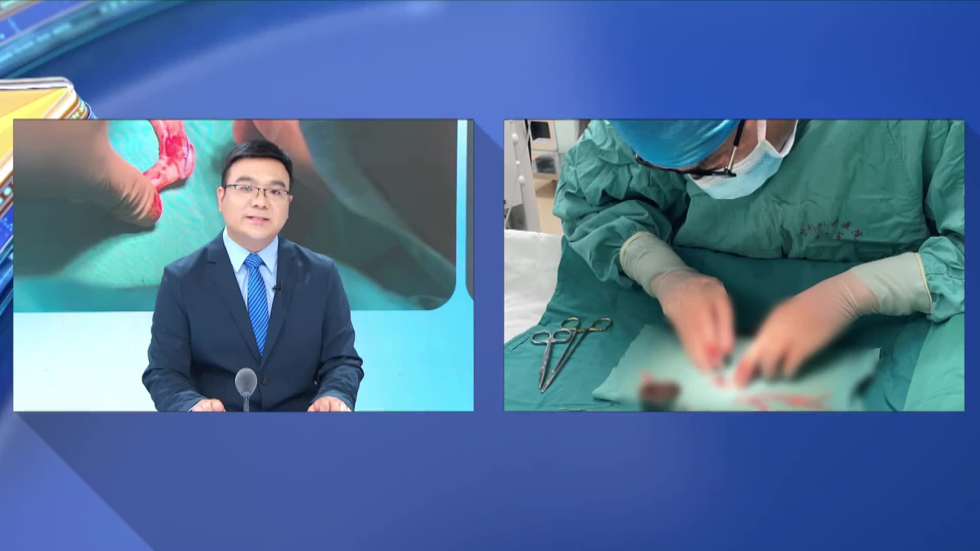 手术能让耳朵“重生” 先天性小耳畸形手术全揭秘