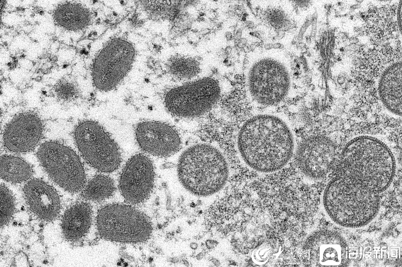 中疾控：11月新增报告80例猴痘确诊病例，均为男性