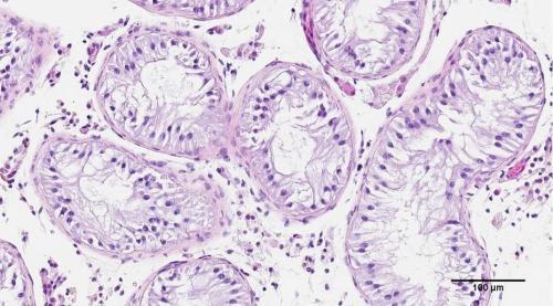 研究发现超1/5试验性干细胞存在致癌突变
