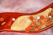 《自然》最新论文：研究揭示如何“一步到位”长效降低小鼠胆固醇