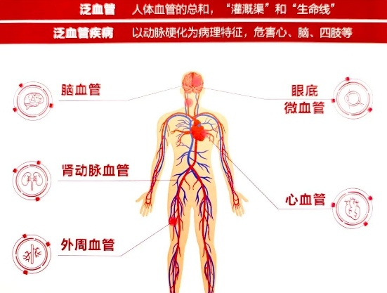 專家串珠成線 數據把脈健康——打造泛血管疾病管理的“濟南樣板”